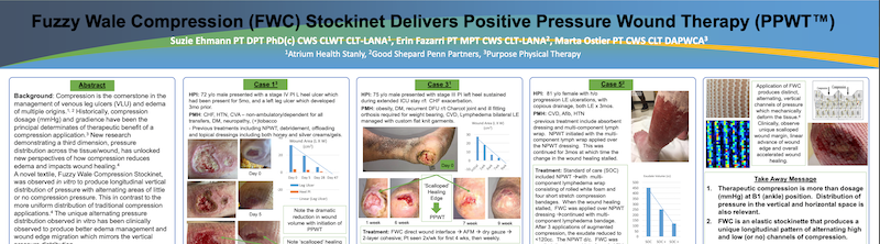 Using Pneumatic Compression to Reduce Edema and Jumpstart Wound Healing