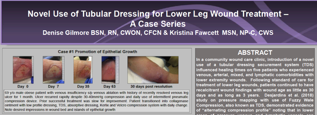 Using Pneumatic Compression to Reduce Edema and Jumpstart Wound Healing